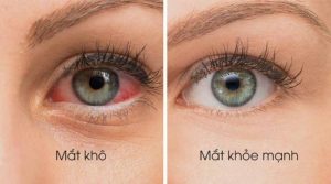 Kính mắt bảo vệ mắt khô