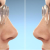 👓 Tròng Kính Siêu Mỏng – Nhẹ, Trong Suốt, Thẩm Mỹ Cao