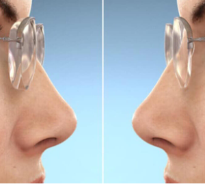 👓 Tròng Kính Siêu Mỏng – Nhẹ, Trong Suốt, Thẩm Mỹ Cao